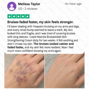 Bruise Shield & Skin-Strengthening Cream - Image 4