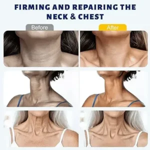 5-Ball Roller Neck Firming Cream with Retinol & Hyaluronic Acid - Image 6