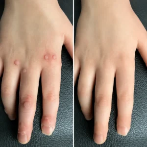 2-in-1 Cryo-Cooling Bump Renewal Spray - Image 6