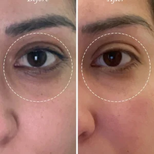 ALISANDA Golden Glow Eye Balm — Ghee + Gotu Kola - Image 8
