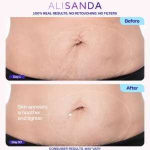 ALISANDA Tighten & Smooth Belly Cream - Image 6