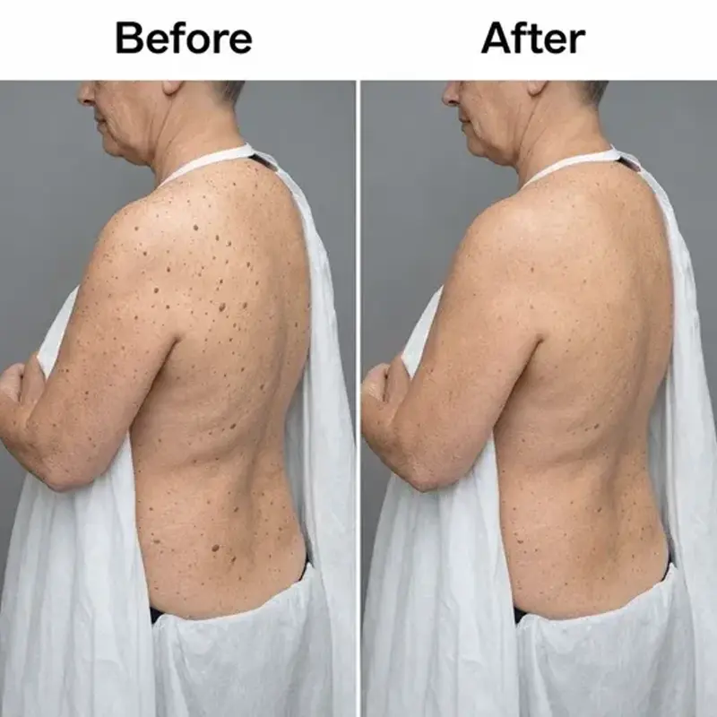 Acezozla Glycolic Body Stick - Image 5