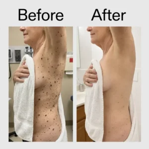 Acezozla Glycolic Body Stick - Image 9