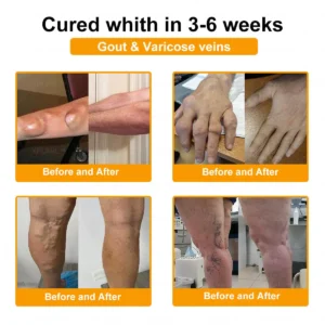 Bee Venom Pain-Relief Bone Healing Cream - Image 5