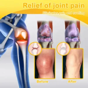Bee Venom Pain-Relief Bone Healing Cream - Image 9