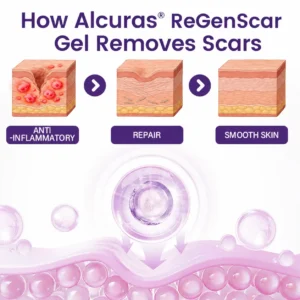 ReGenScar Stem Cell Scar Gel - Image 4