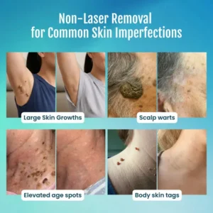 SpotlessPro Advanced Skin Care Pen - Image 2