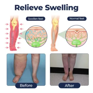 SwellRelief Circulation Support Cream - Image 4