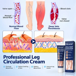 SwellRelief Circulation Support Cream - Image 5