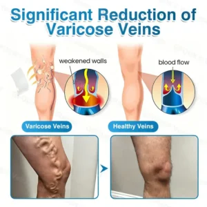 VeinRepair Microneedle Patch Roll - Image 7