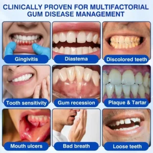 GumRevive Periodontal Repair Gel - Image 10