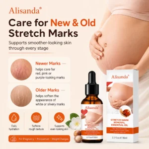 Alternative view of SilkStretch Natural Stretch Mark & Scar Oil