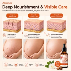 SilkStretch Natural Stretch Mark & Scar Oil - Image 3