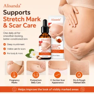 SilkStretch Natural Stretch Mark & Scar Oil - Image 6