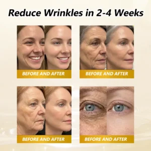 BEE VENOM BIO-REVIVE BODY ROLLER - Image 2
