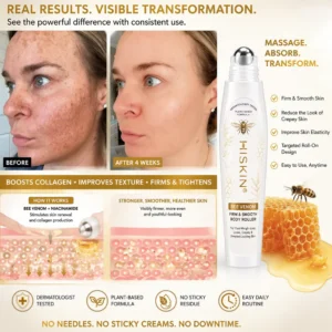 BEE VENOM BIO-REVIVE BODY ROLLER - Image 8