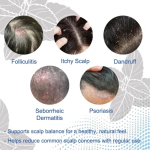NESLEMY Folliculitis Shampoo for Itchy - Image 2