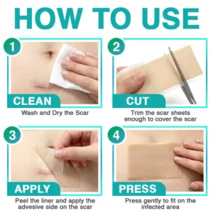 3-in-1 Scar Removal Microneedle Care Patch - Image 12