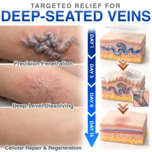 Varicose Veins Treatment Microneedle Patch - Image 5