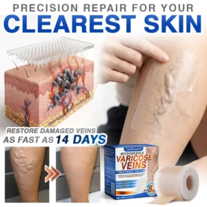 Varicose Veins Treatment Microneedle Patch - Image 9