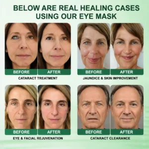 Presbyopia Mask - Image 4
