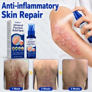 Advanced Psoriasis Relief Spray - Image 4