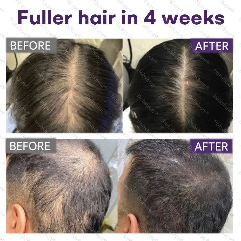 Black Rice & Red Onion Hair Growth Spray - Image 2