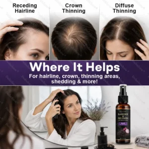 Black Rice & Red Onion Hair Growth Spray - Image 7