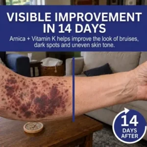 Dark Spot & Bruise Recovery Cream - Image 4