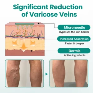 LegRenew Varicose Vein Patch - Image 2
