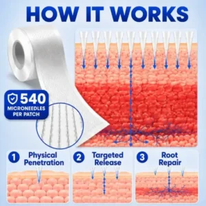 Micro Needle Patch Roll - Image 4