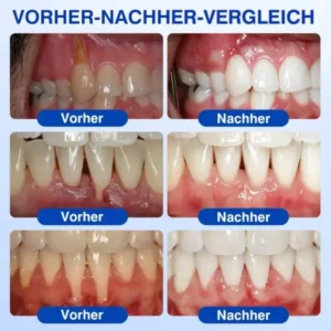 GumRevive Parodontales Reparaturgel - Image 12