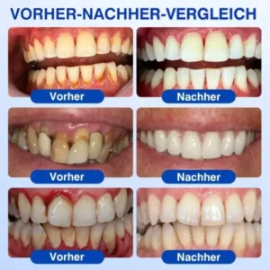 GumRevive Parodontales Reparaturgel - Image 13
