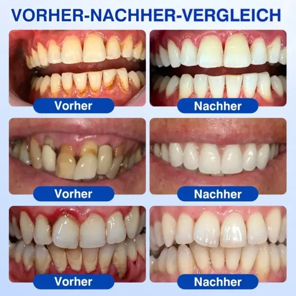 GumRevive Parodontales Reparaturgel - Image 13