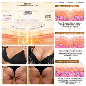 Bust Volume Lift & Firming Nano Microneedle Patch Volufiline + Exosome + Copper Peptide Formula Powered by Cellular Renewal Technology - Image 6