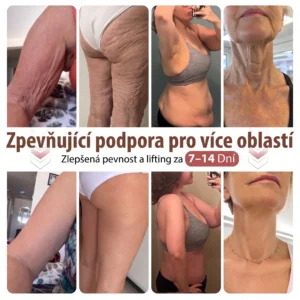 Mikroneedlová náplast pro podporu objemu - Image 10
