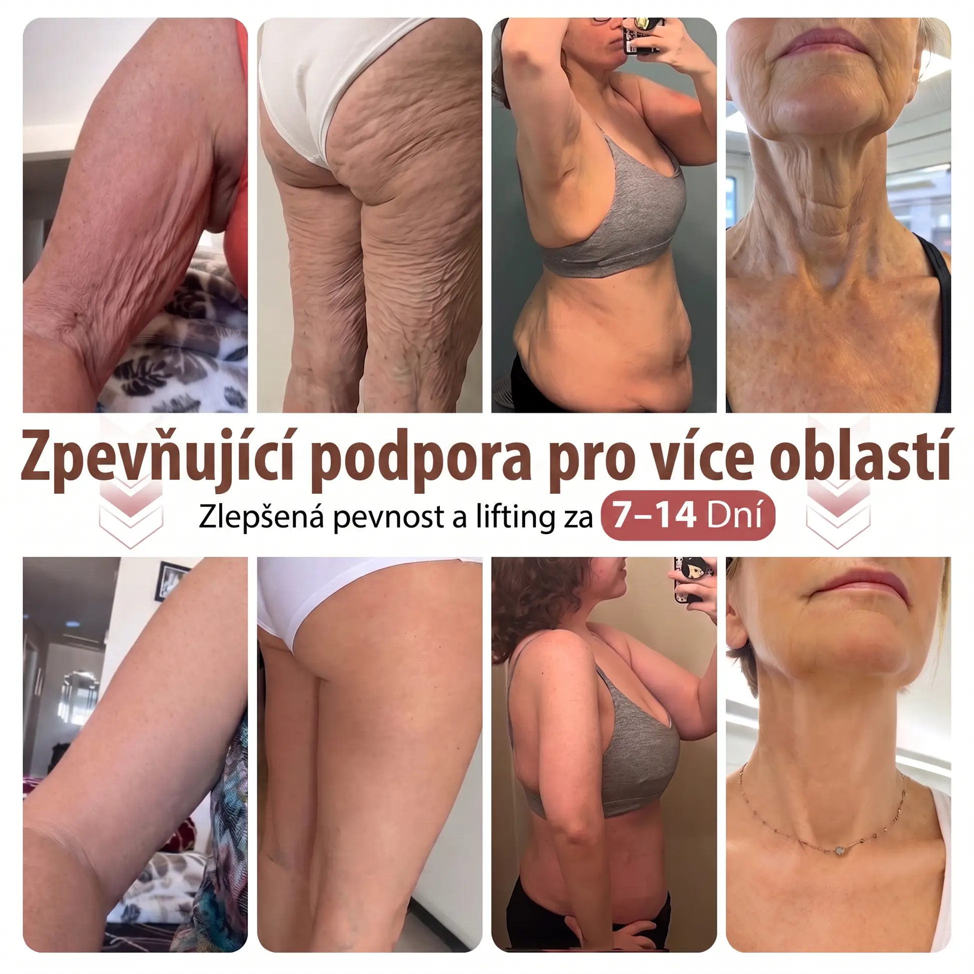 Mikroneedlová náplast pro podporu objemu - Image 10