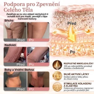 Mikroneedlová náplast pro podporu objemu - Image 17