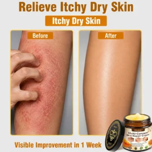 Multi-Concern Skin Repair Cream - Image 10