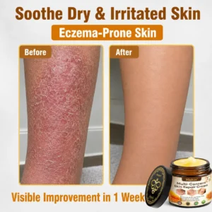 Multi-Concern Skin Repair Cream - Image 11