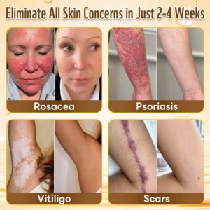 Multi-Concern Skin Repair Cream - Image 4