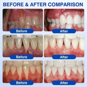 GumRevive gel - Image 8