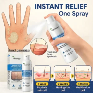 Magnesium Spray - Image 10