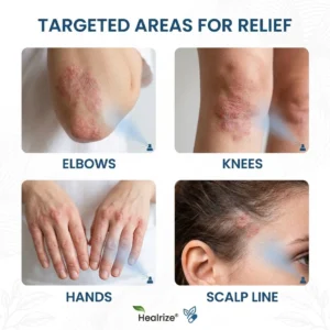 Magnesium Spray - Image 2