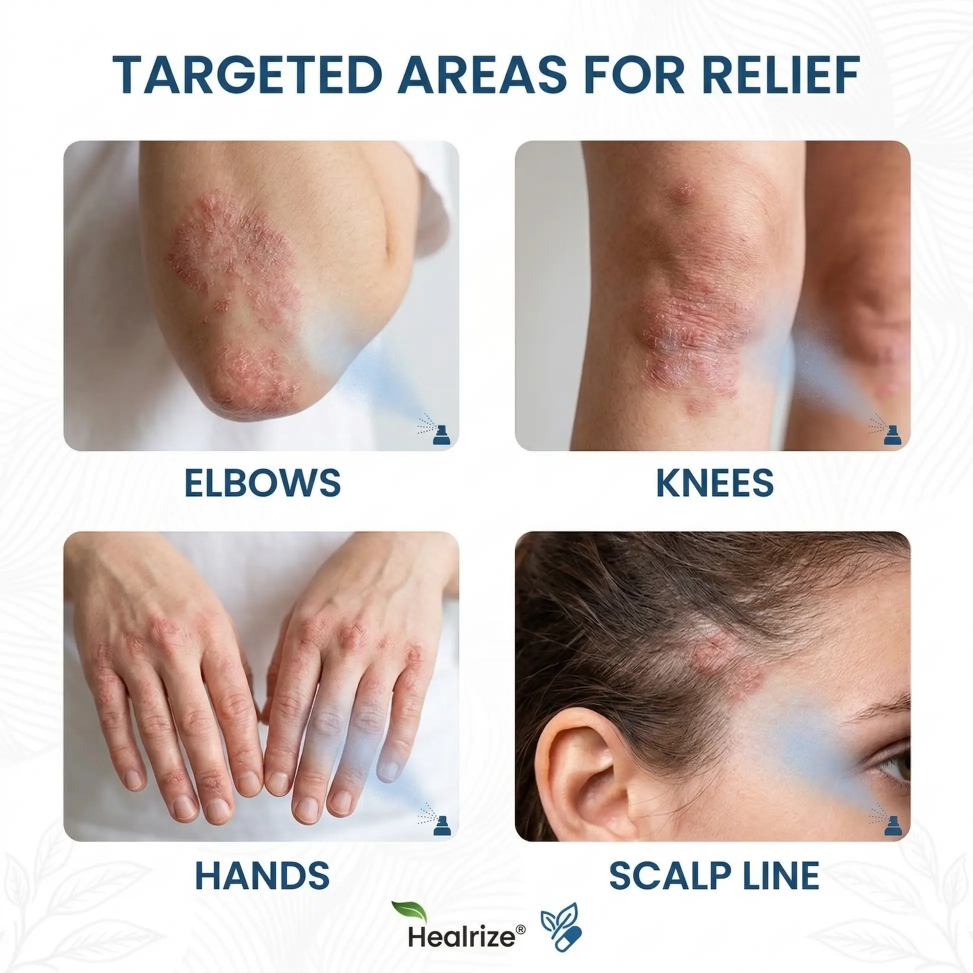 Magnesium Spray - Image 2