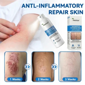 Magnesium Spray - Image 3