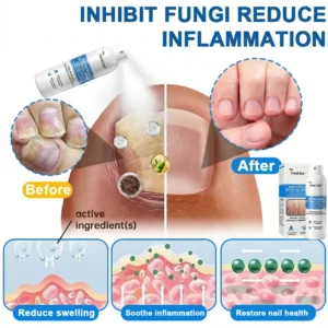 Magnesium Spray - Image 4