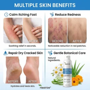 Magnesium Spray - Image 9