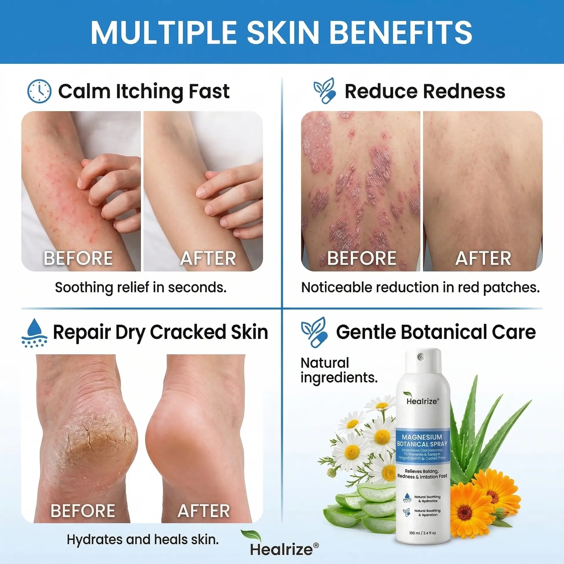 Magnesium Spray - Image 9