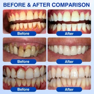 GumRevive Periodontal Repair Gel - Image 2
